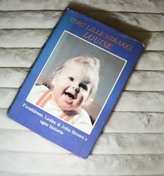 Billede af bogen Vort lille mirakel Louise